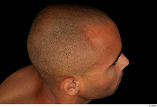 Aaron bald hair 0007.jpg